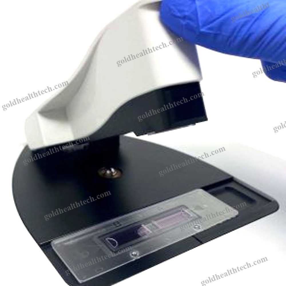 Automated Cell Counter