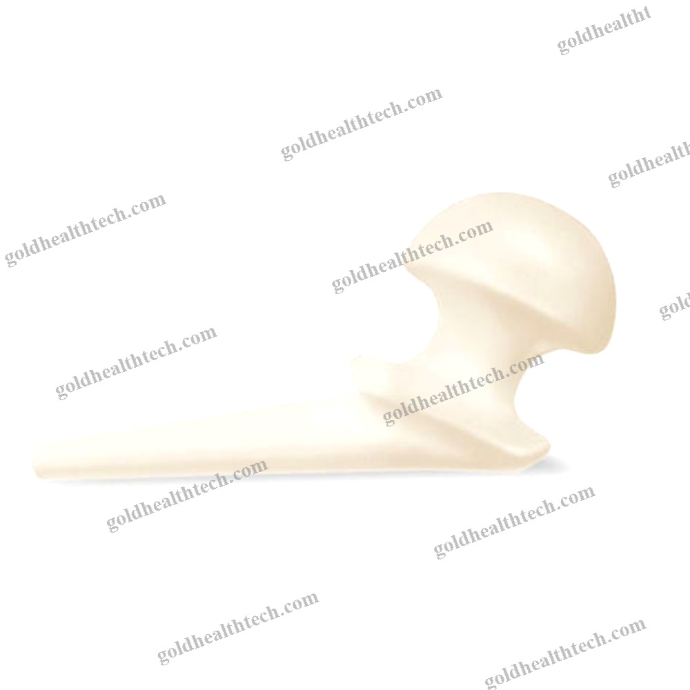 Temporary Hip Spacer