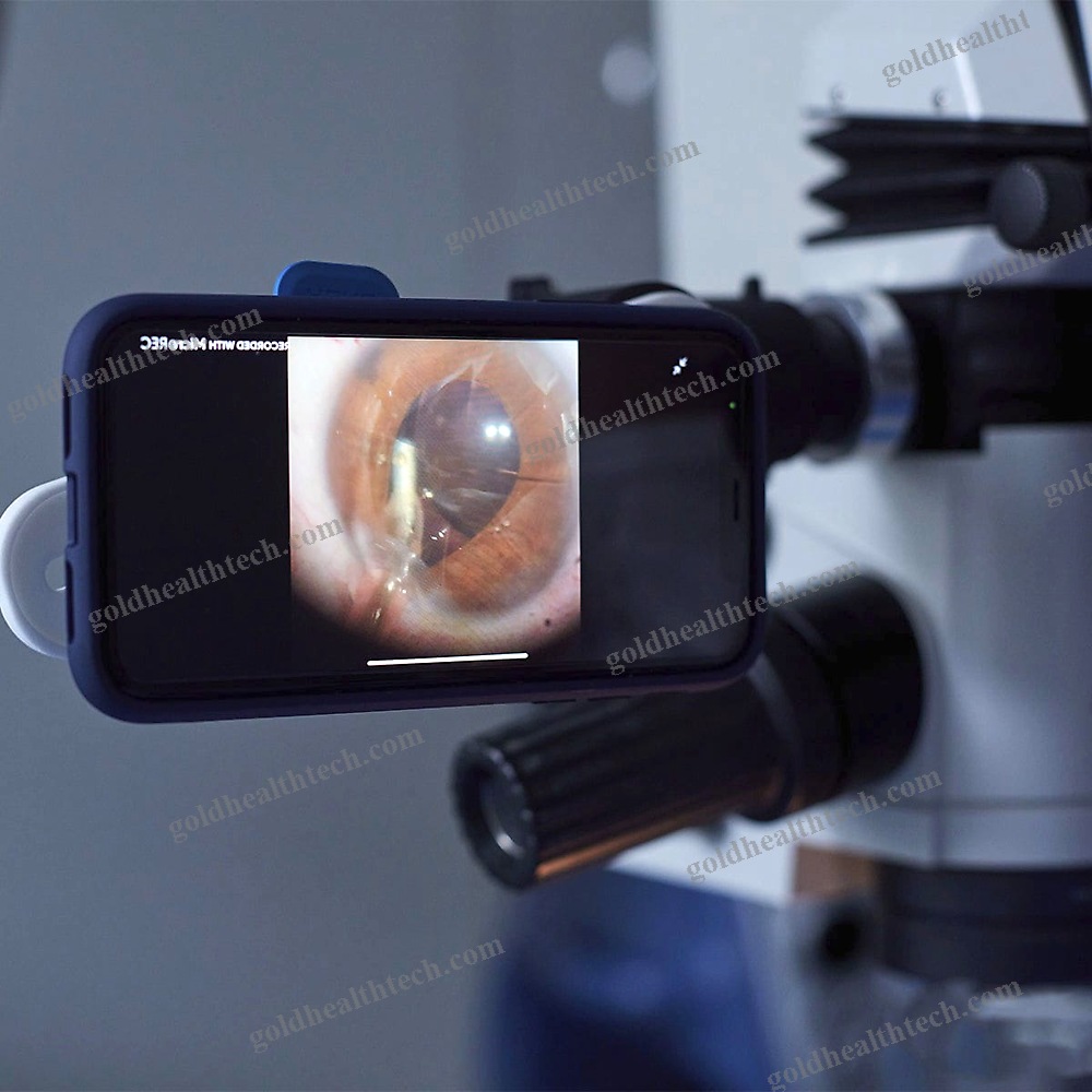 Operating Room Video Recording System