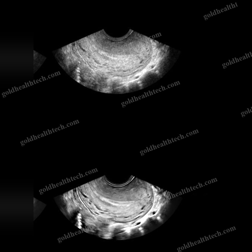 Ultrasound Imaging Software