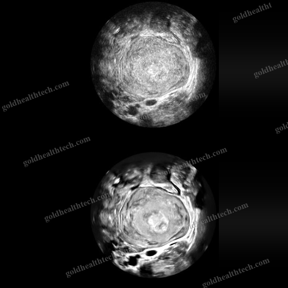 Ultrasound Imaging Software