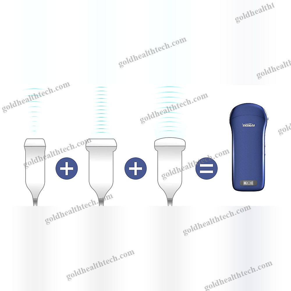 Hand-Held Ultrasound System
