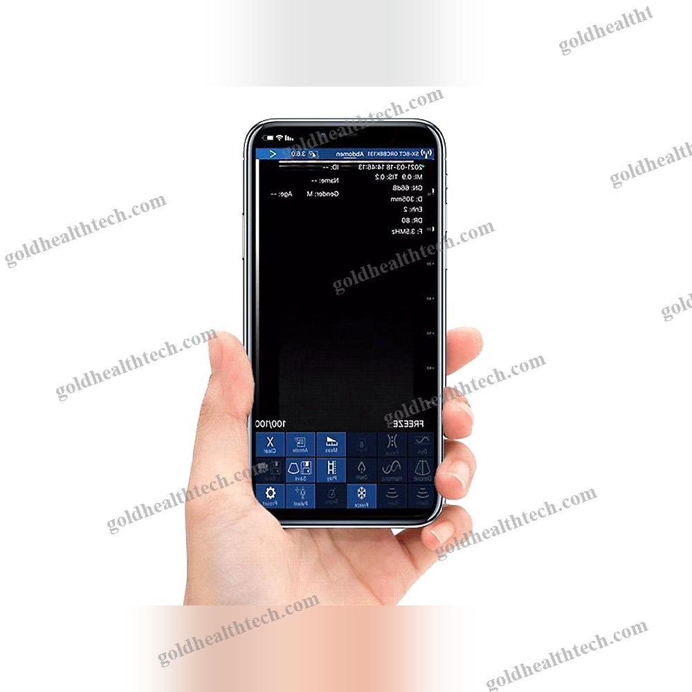 Hand-Held Ultrasound System