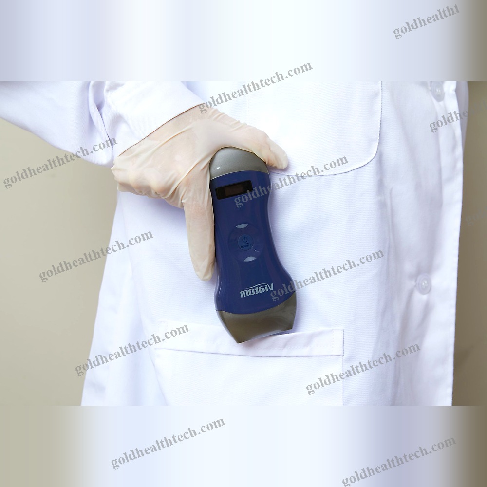 Hand-Held Ultrasound System