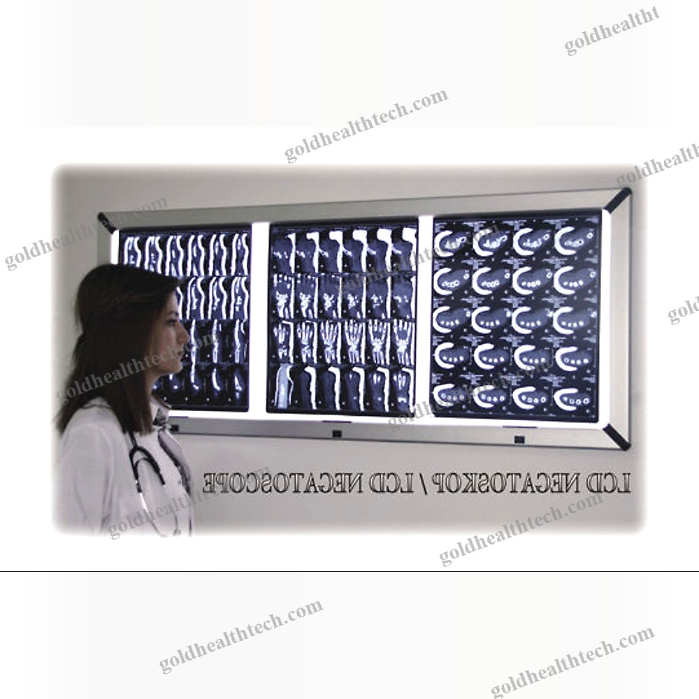 Digital X-Ray Film Viewer