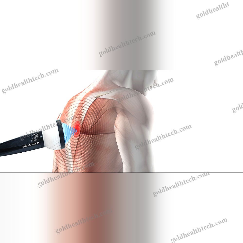 Orthopedic Treatment Eswt Unit