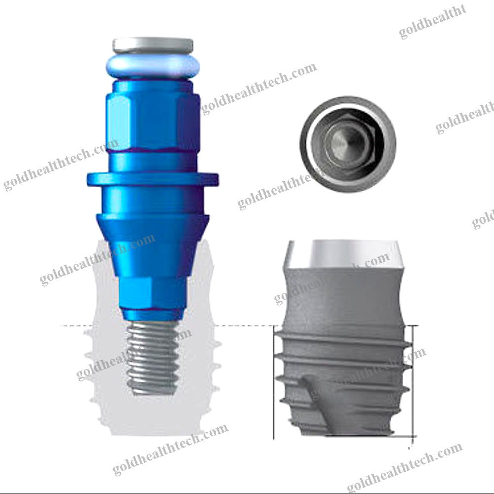 Titanium Dental Implant