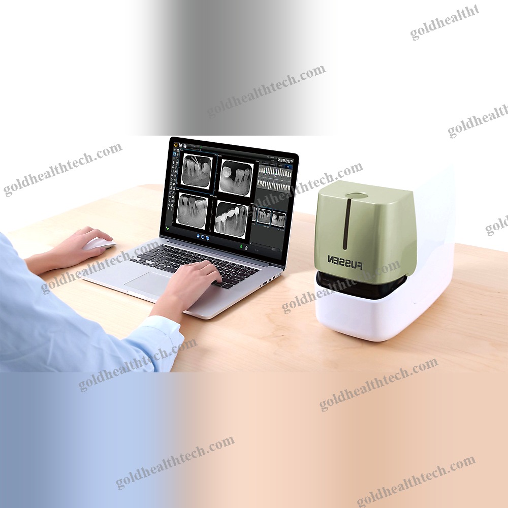 Intraoral Cr Scanner