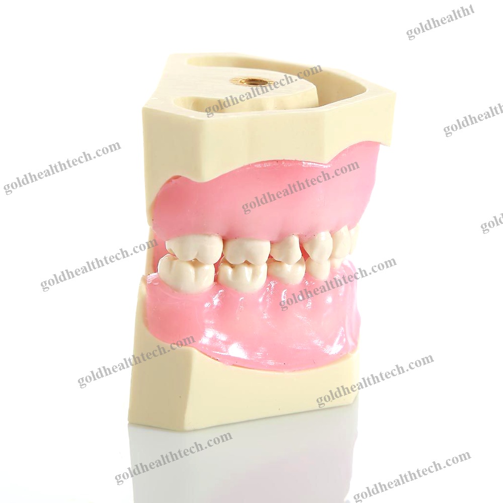 Denture Model
