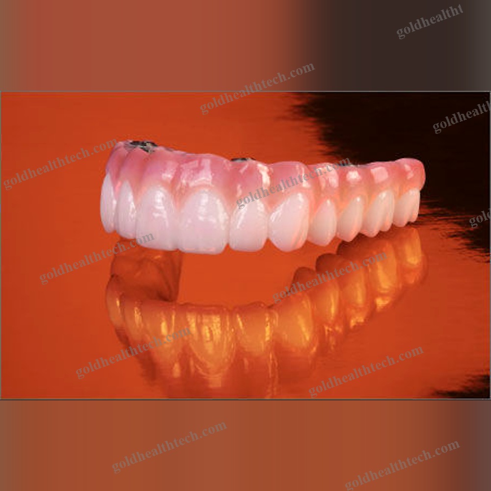 Zirconia Dental Prosthesis