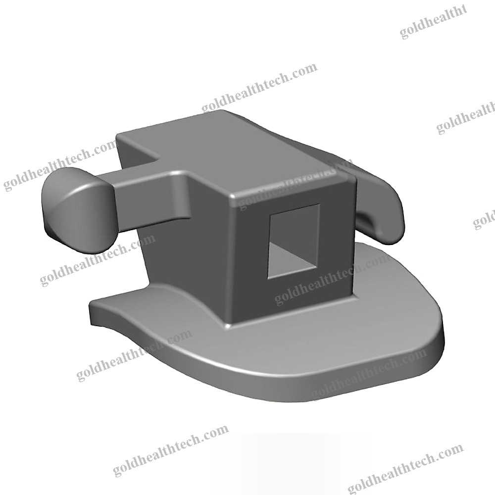 Bonded Buccal Tube