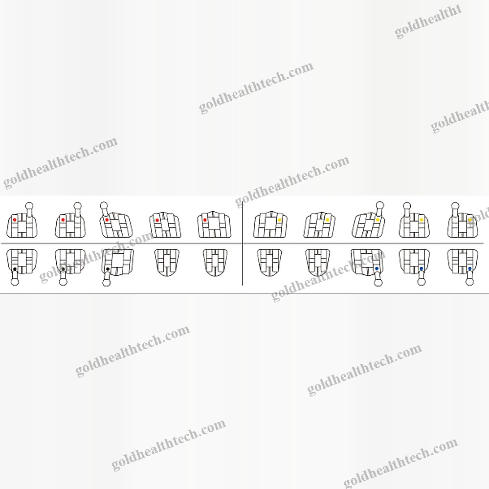 Metal Orthodontic Bracket