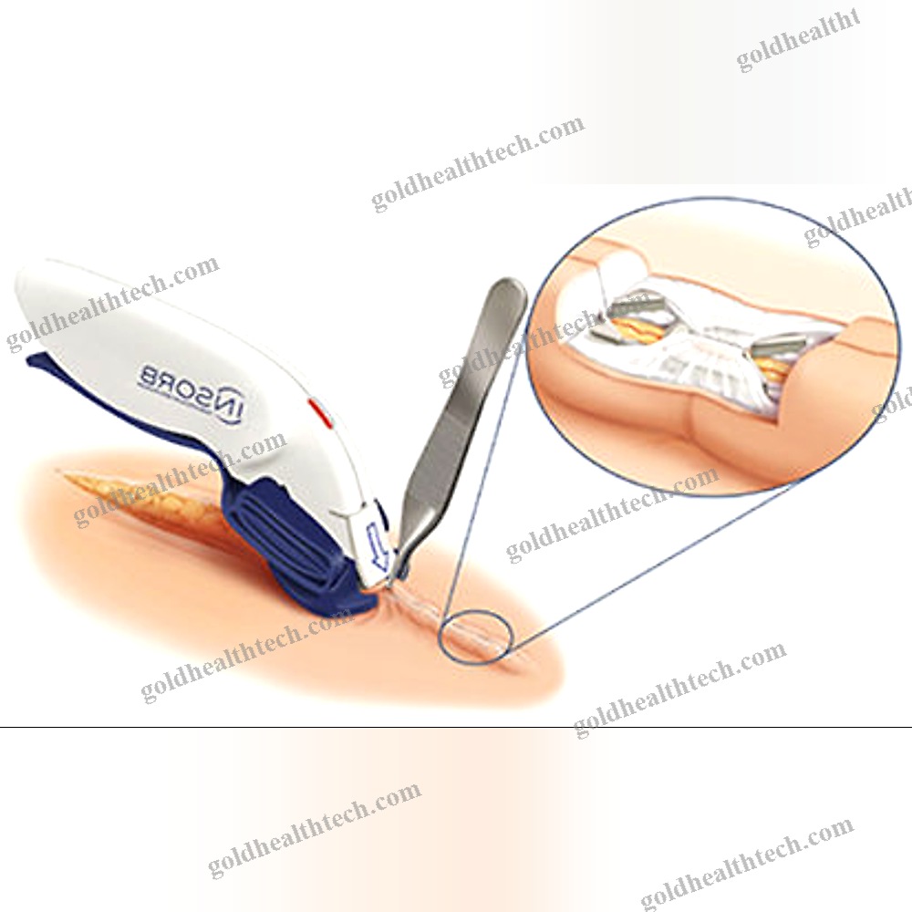 Skin Closure Surgical Stapler