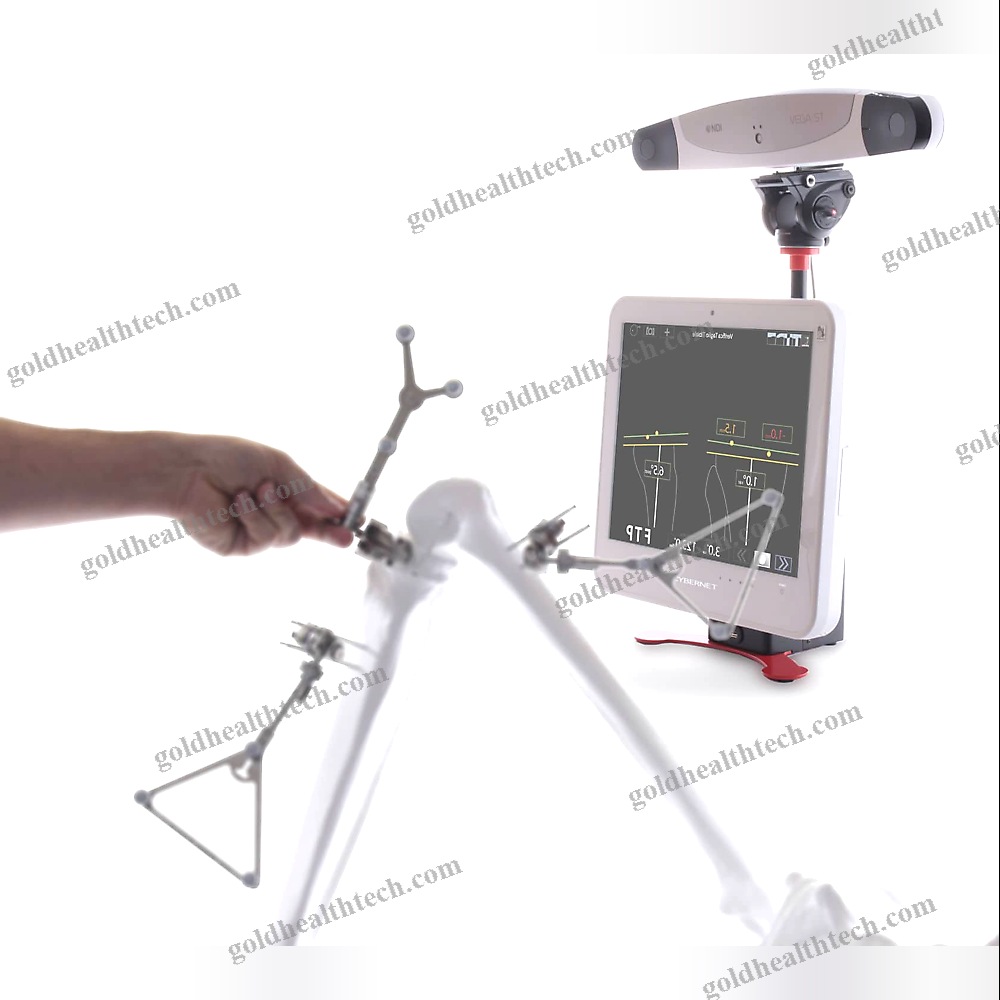 Knee Prosthesis Positioning Surgical Navigation System