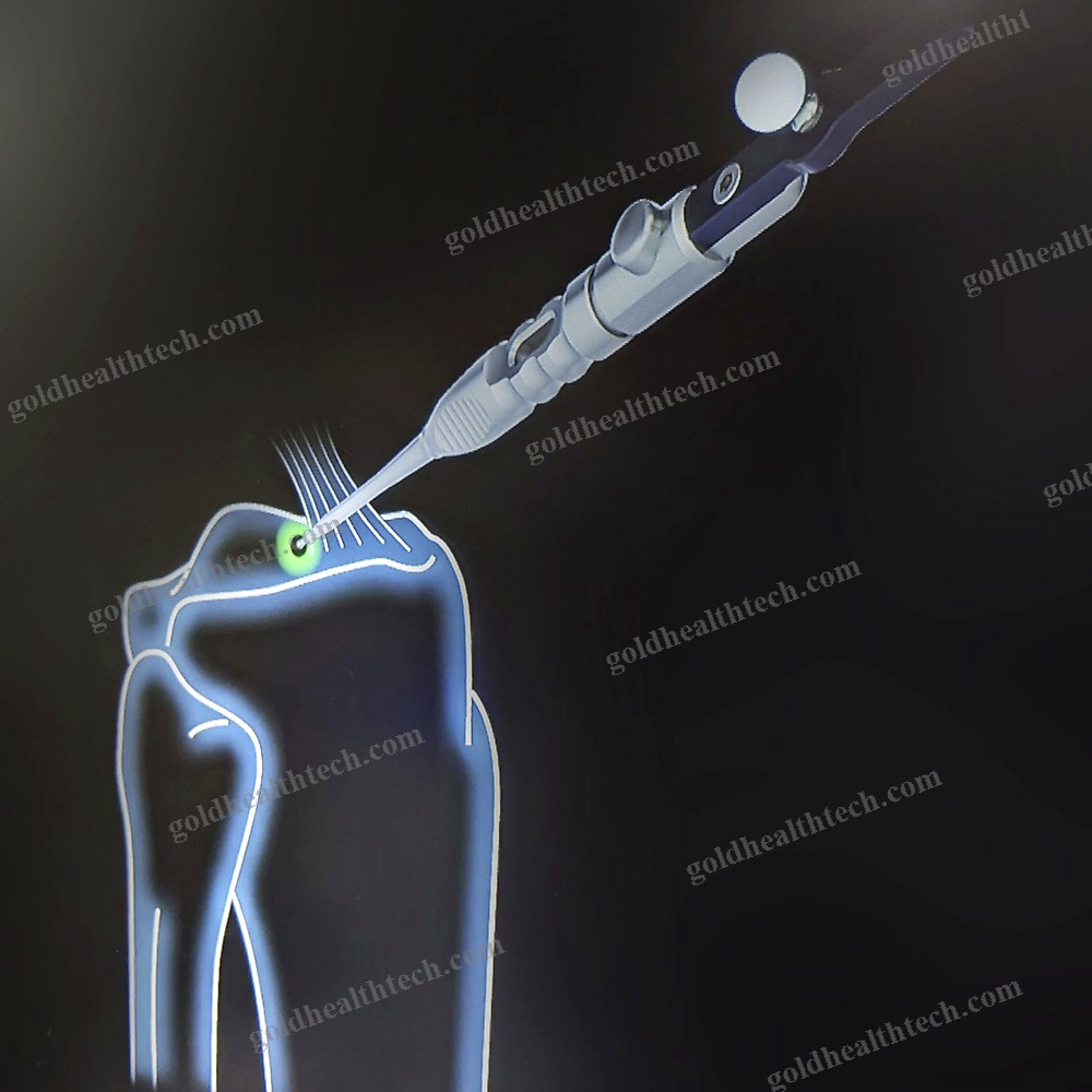 Knee Prosthesis Positioning Surgical Navigation System