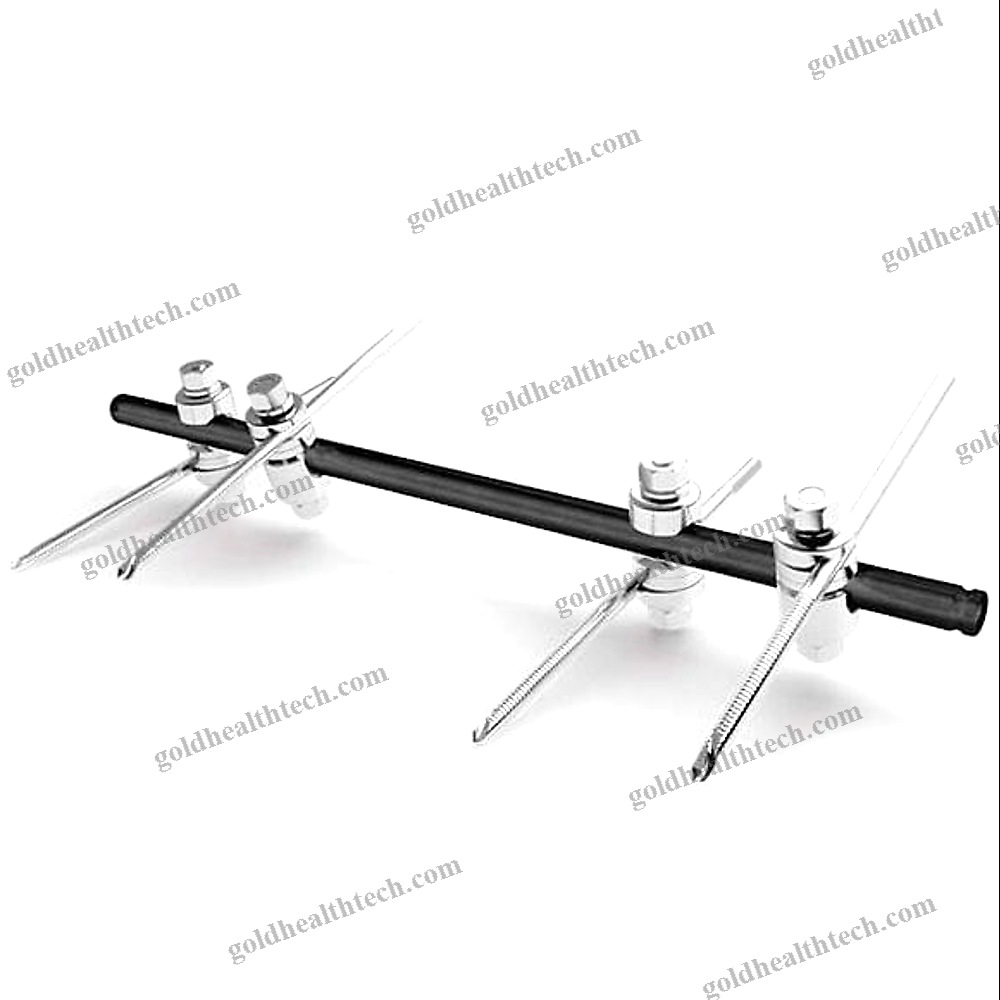 Modular External Fixation System