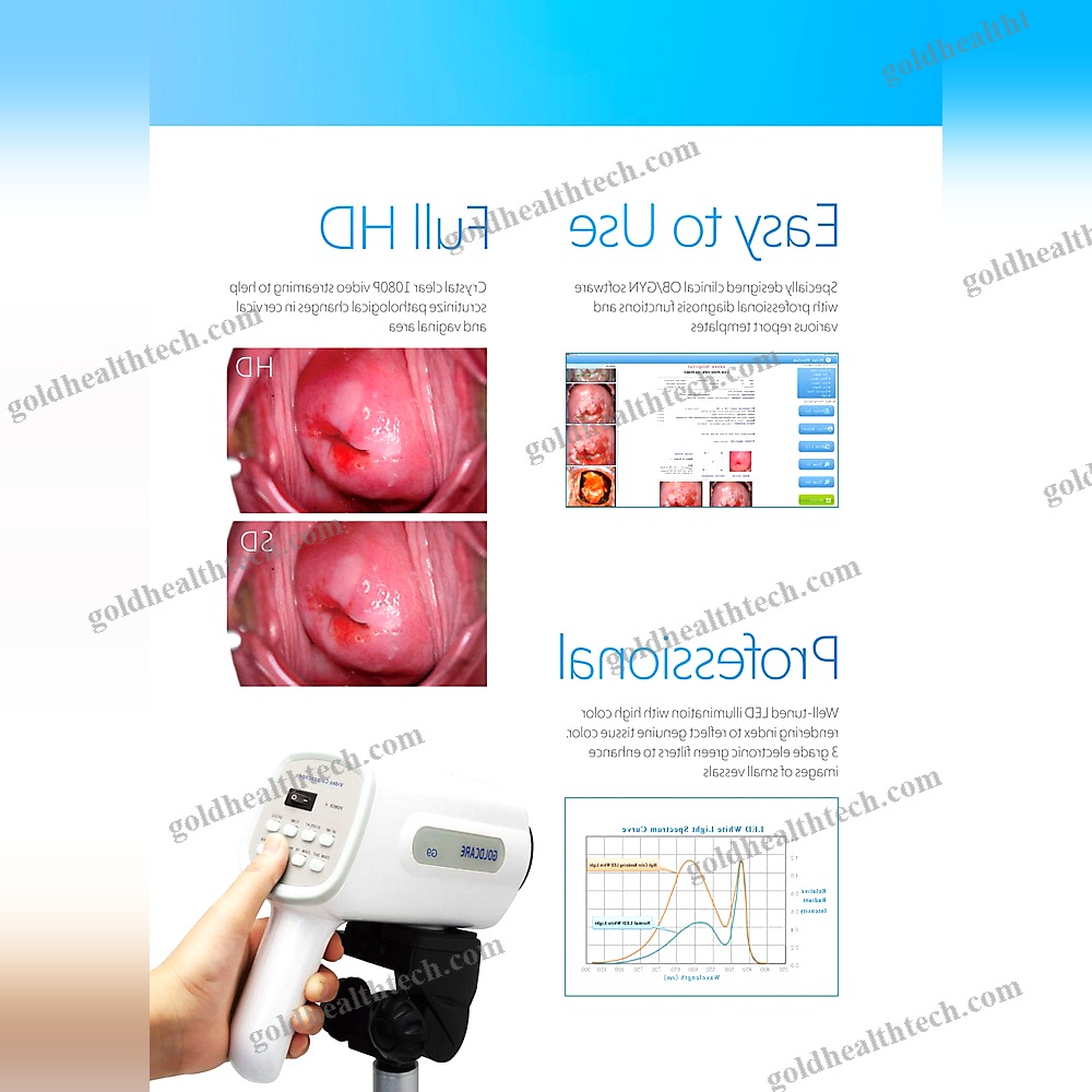 Video Colposcope