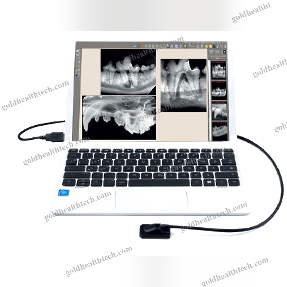 Veterinary Intra-Oral Detector