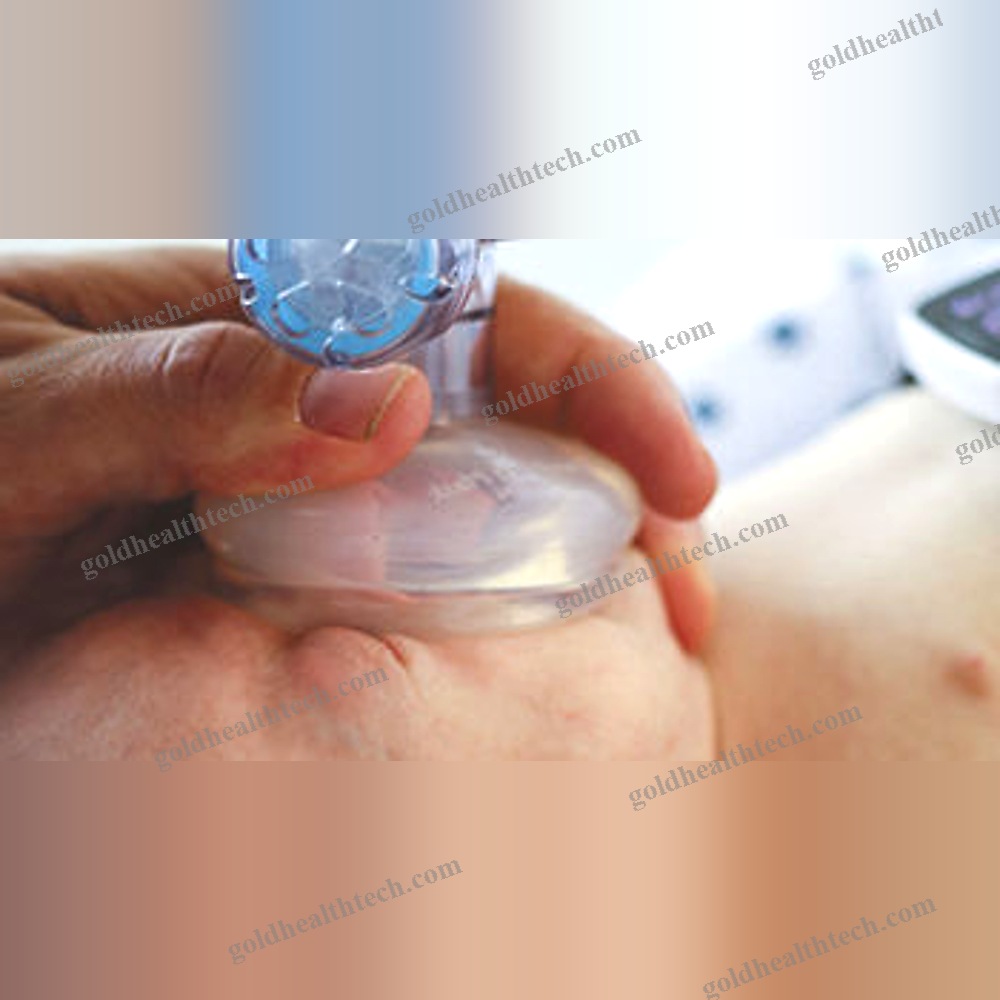 Pediatric Manual Resuscitator