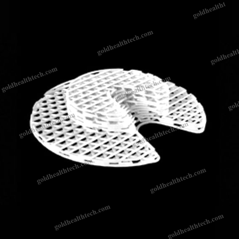 Absorbable Cranial Implant