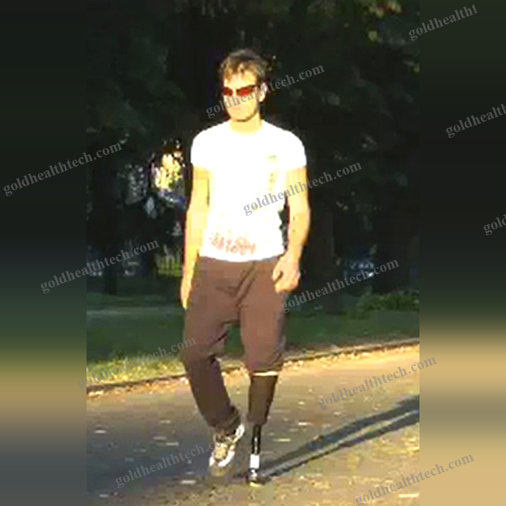 Dynamic Prosthetic Foot