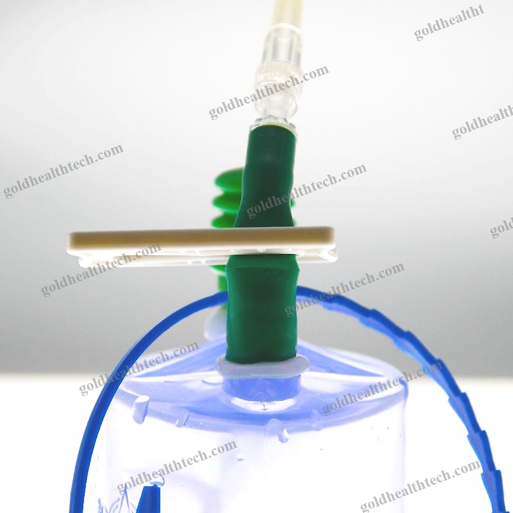Manual Negative Pressure Wound Therapy Unit