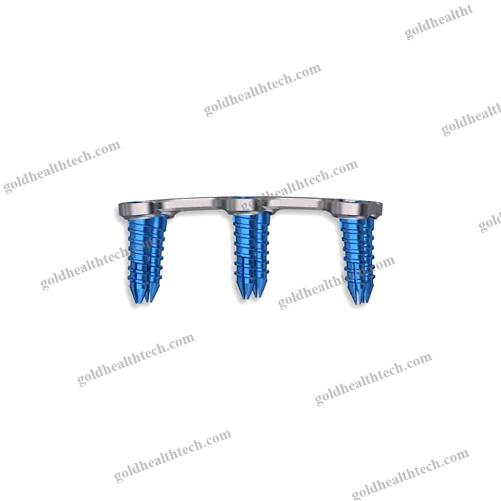 Cervical Arthrodesis Plate
