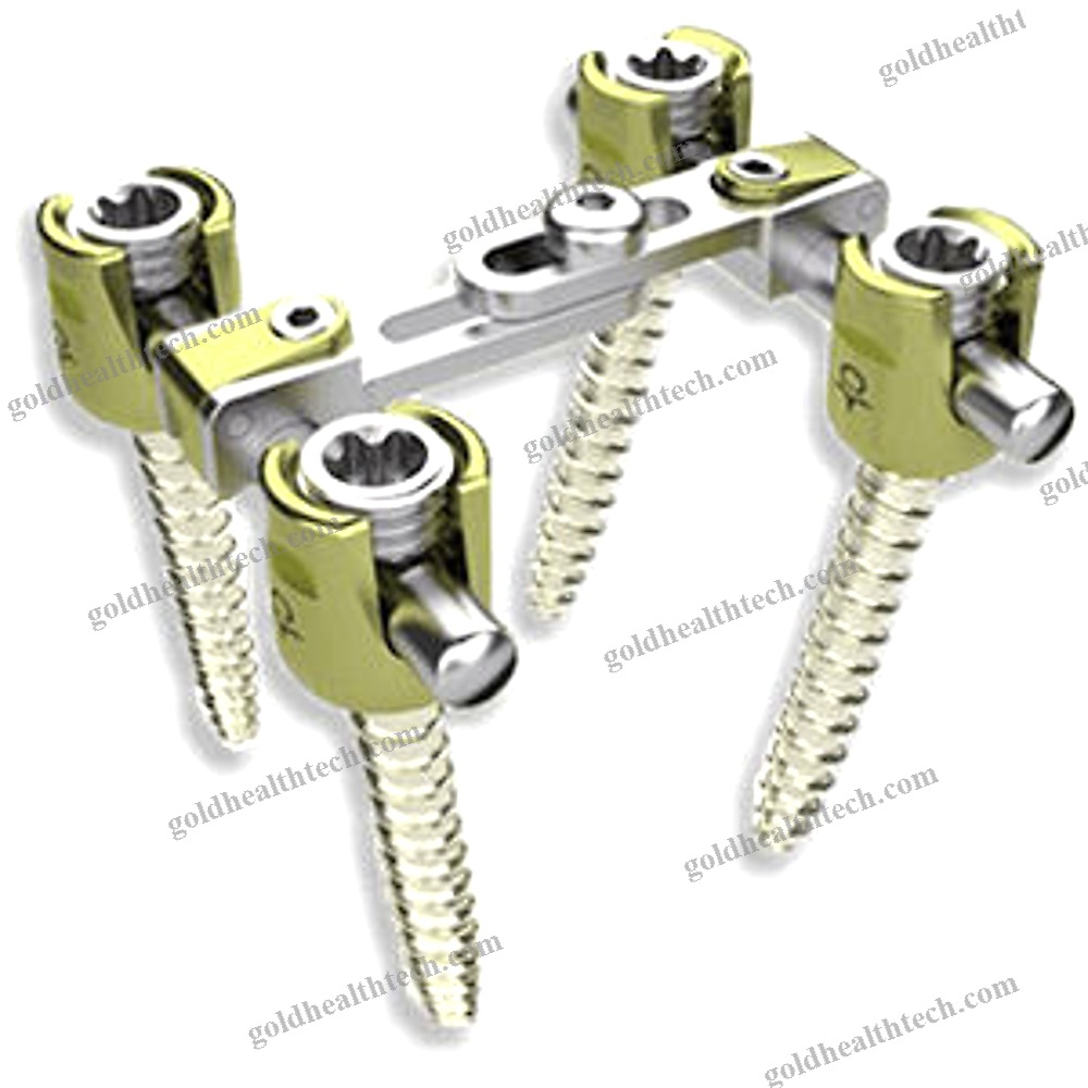 Thoraco-Lumbar Osteosynthesis Unit