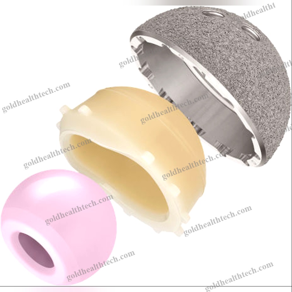 Cementless Acetabular Prosthesis