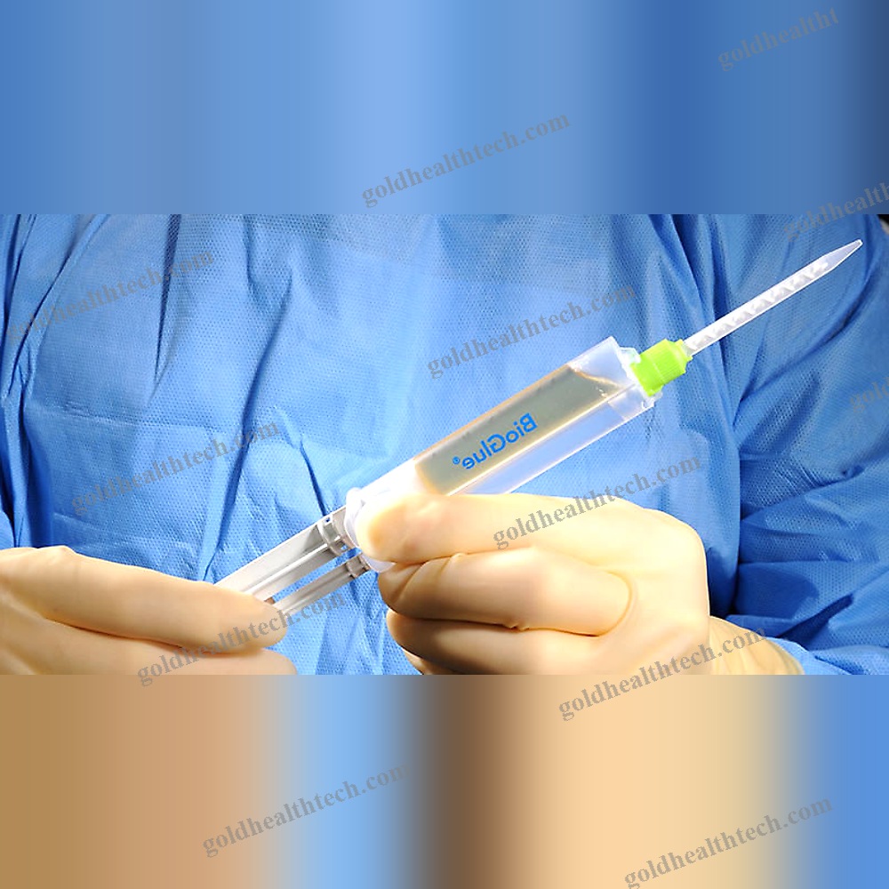 Vascular Surgery Tissue Adhesive