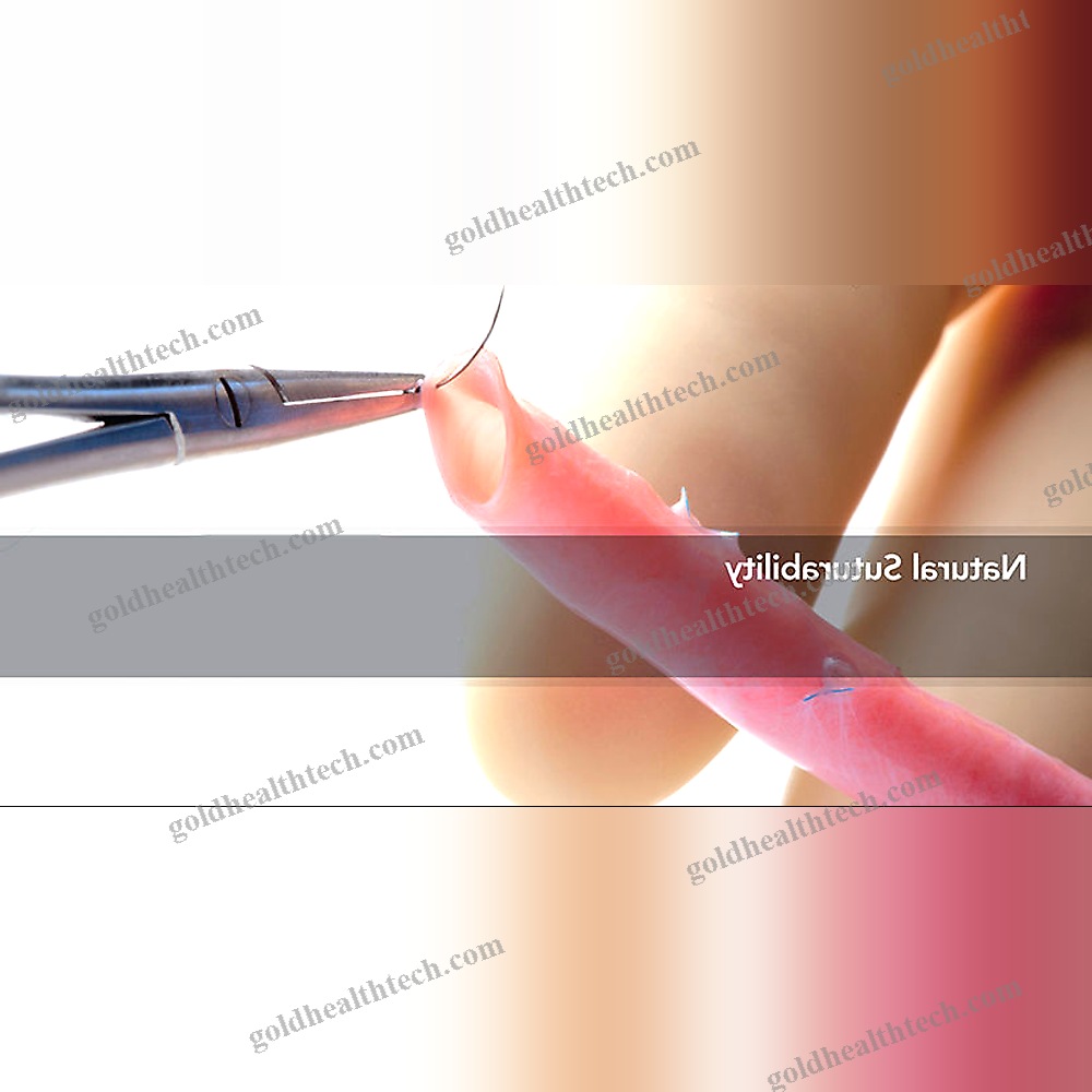 Femoral Vein Vascular Bioprosthesis