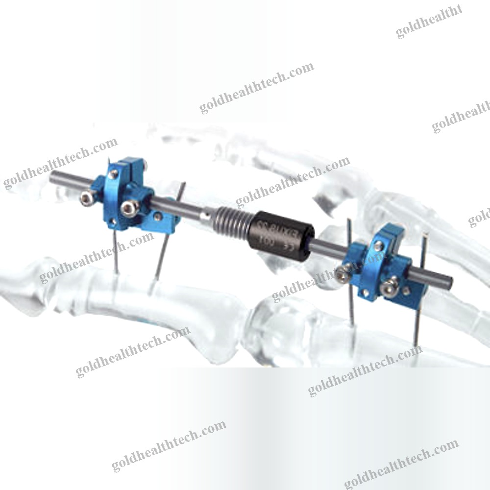Metacarpophalangeal Joint External Fixation System