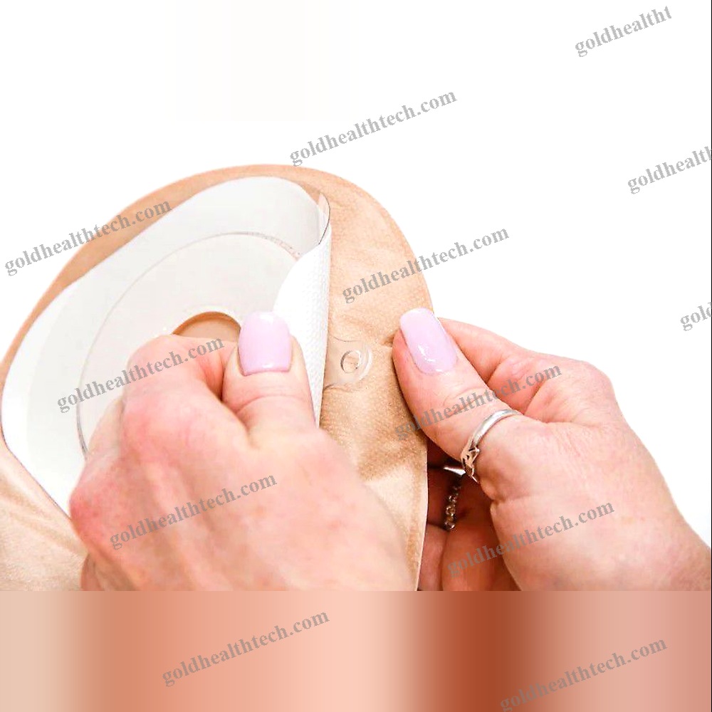 Ileostomy Bag