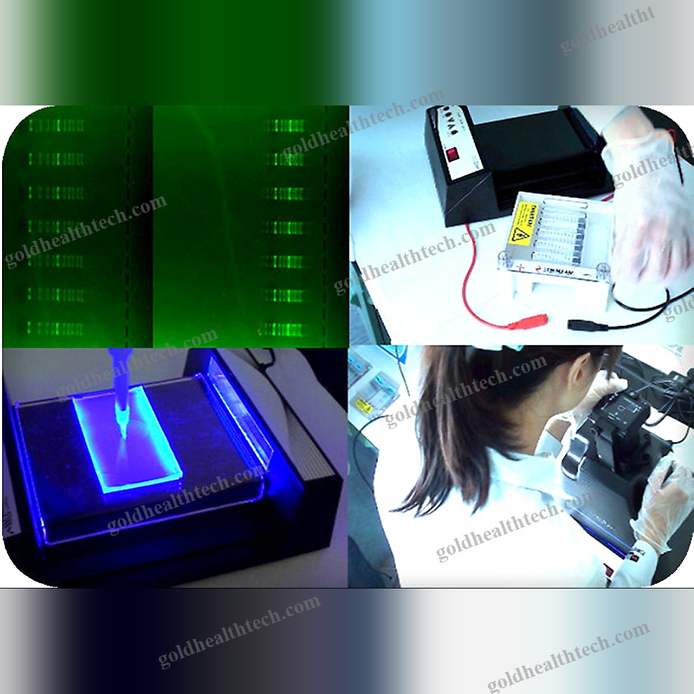 Agarose Gel Electrophoresis System