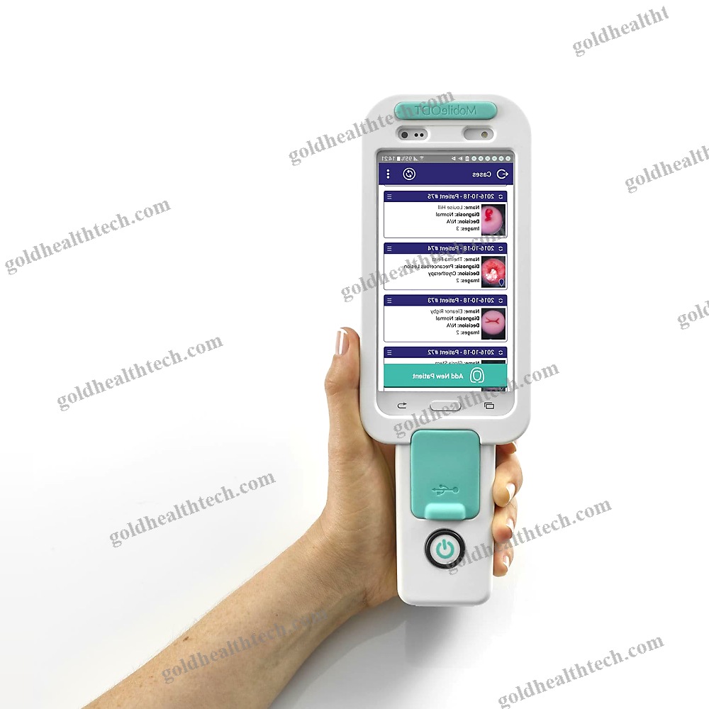 Video Colposcope