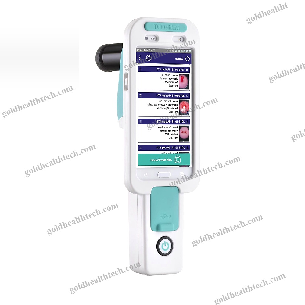Video Colposcope