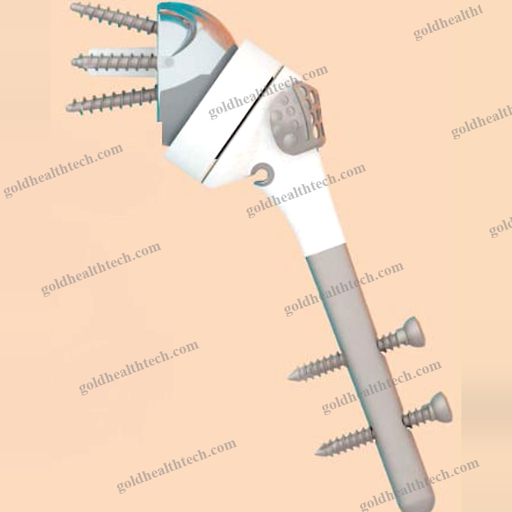 Reverse Shoulder Prosthesis
