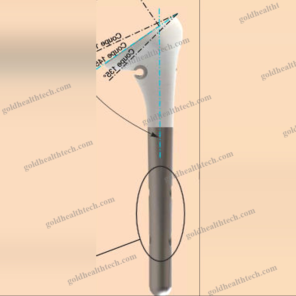 Reverse Shoulder Prosthesis