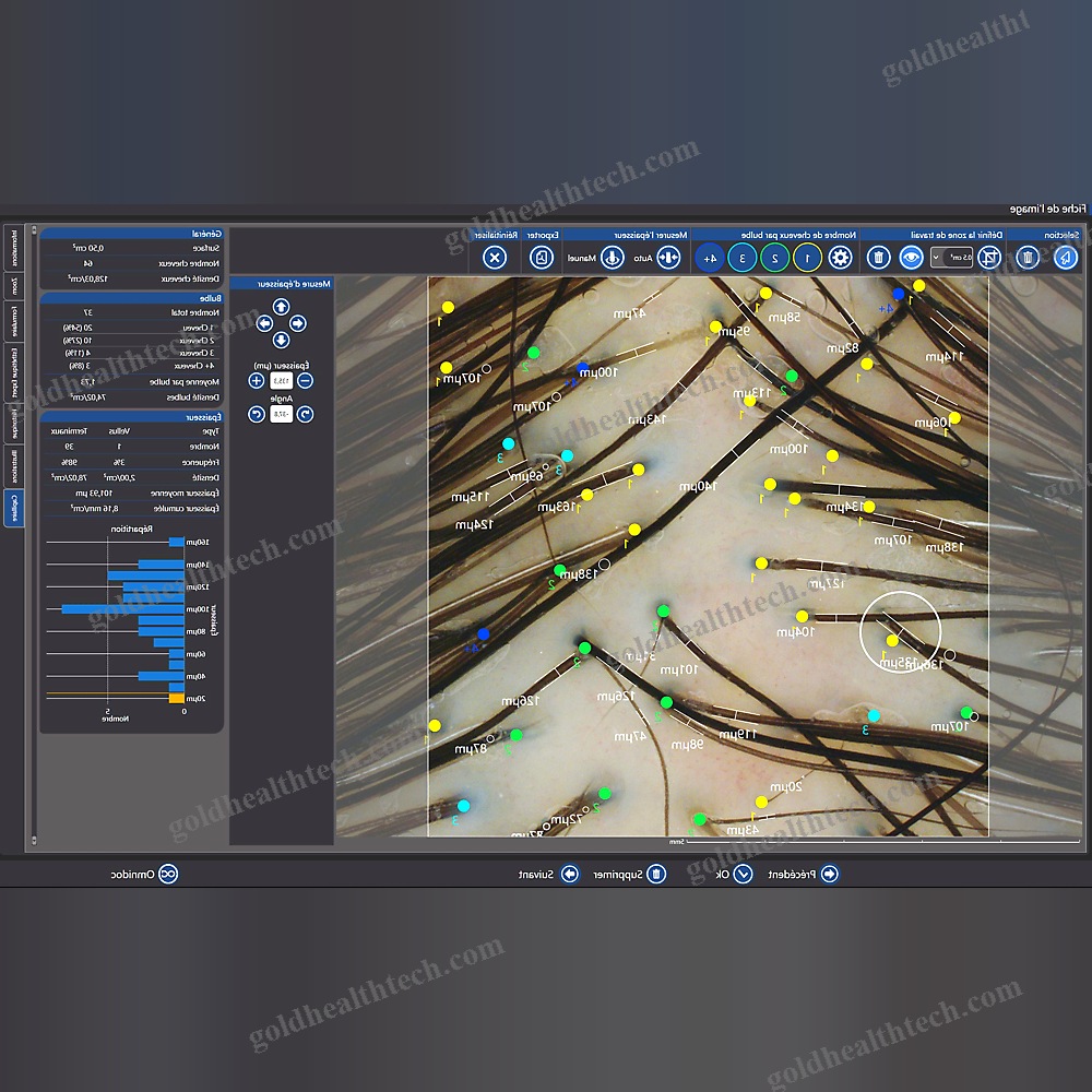 Video Trichoscope