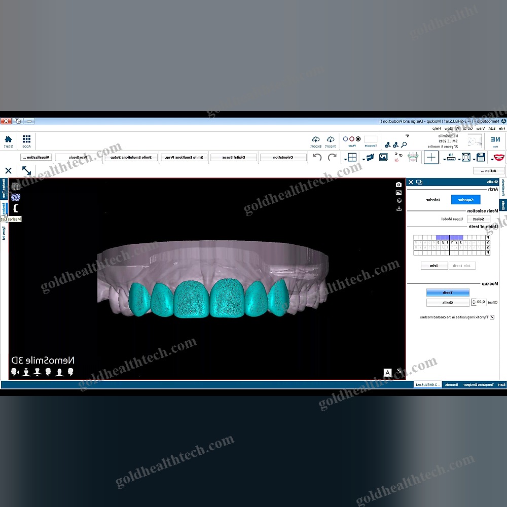 Digital Smile Design Software