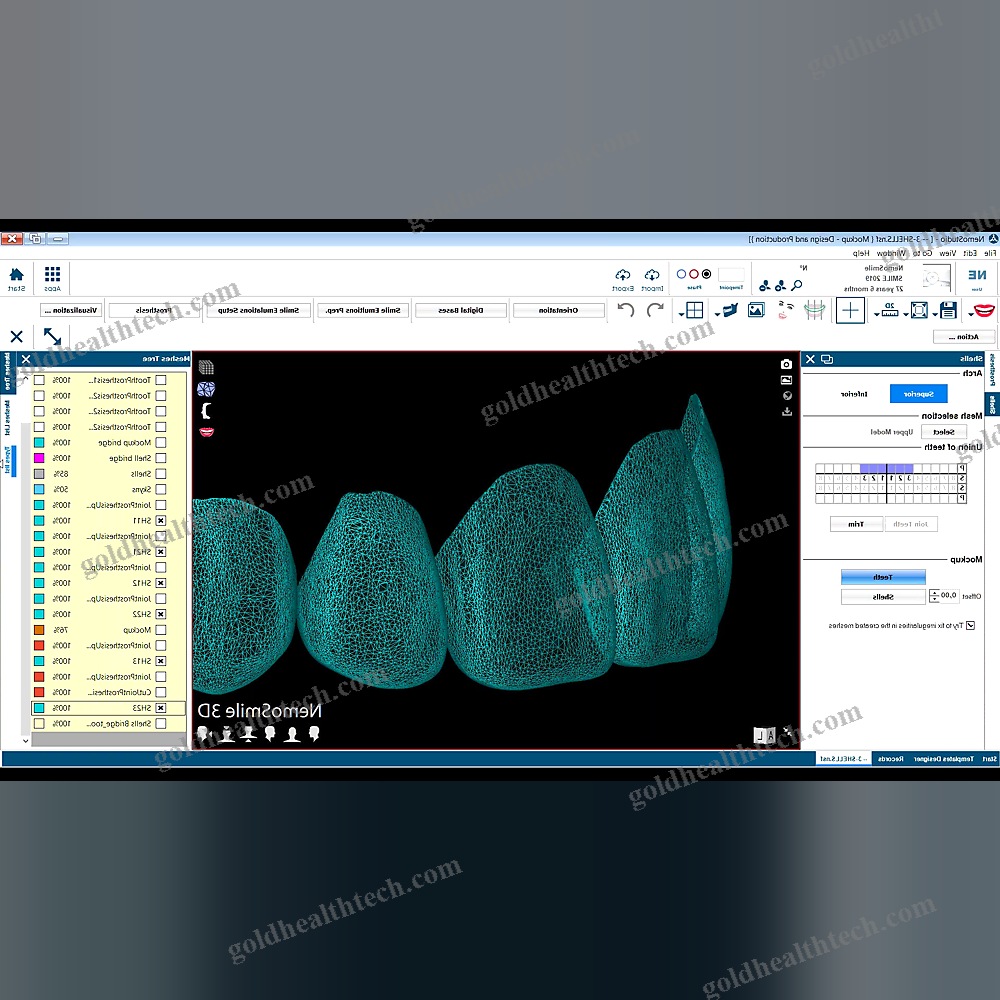 Digital Smile Design Software