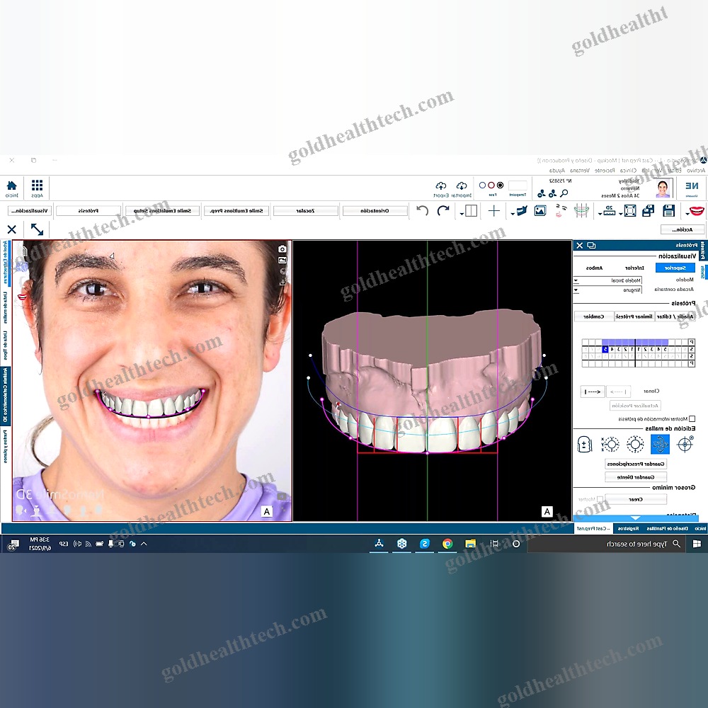 Digital Smile Design Software