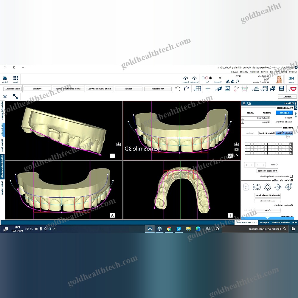 Digital Smile Design Software