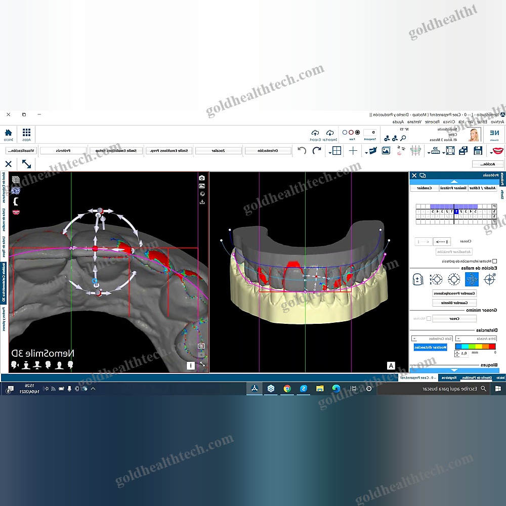 Digital Smile Design Software