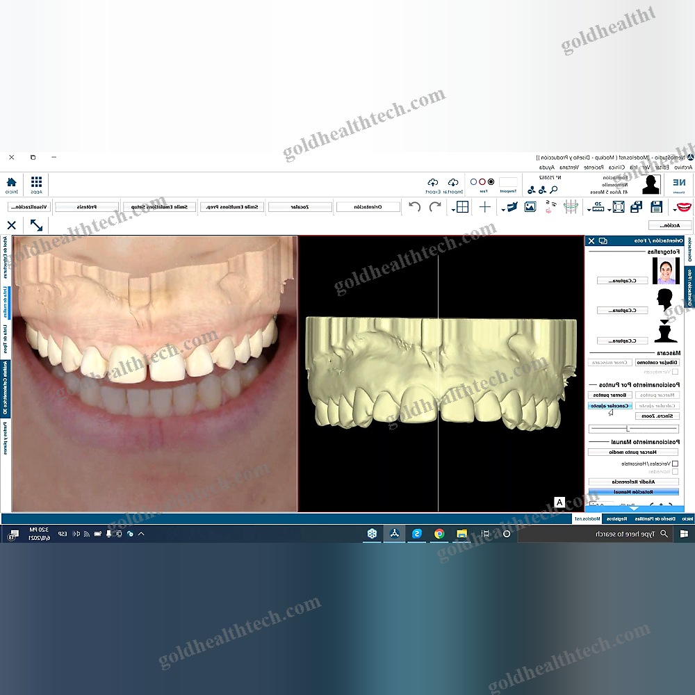 Digital Smile Design Software