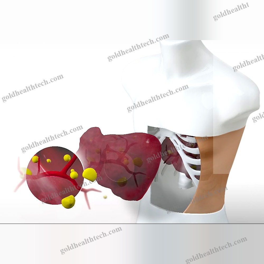 Radiosurgery Test Phantom