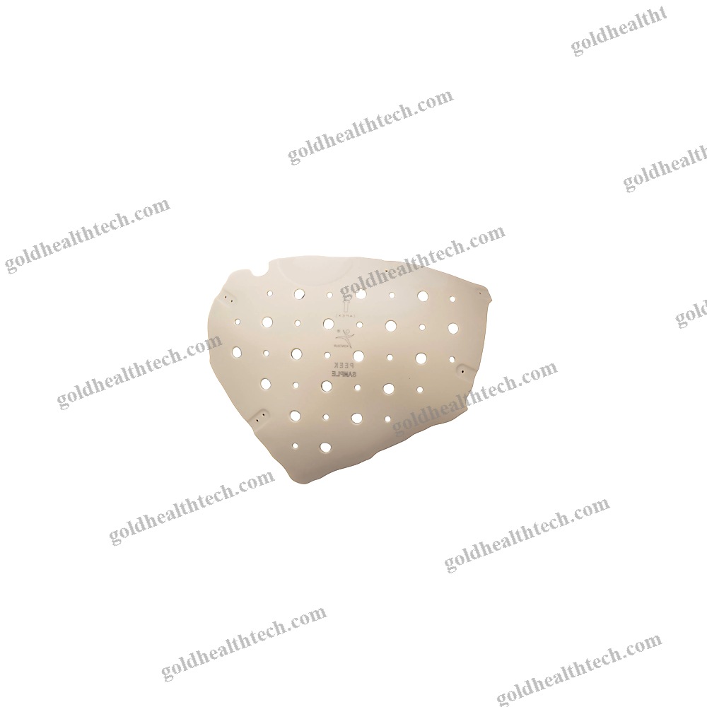 Custom-Made Cranial Implant