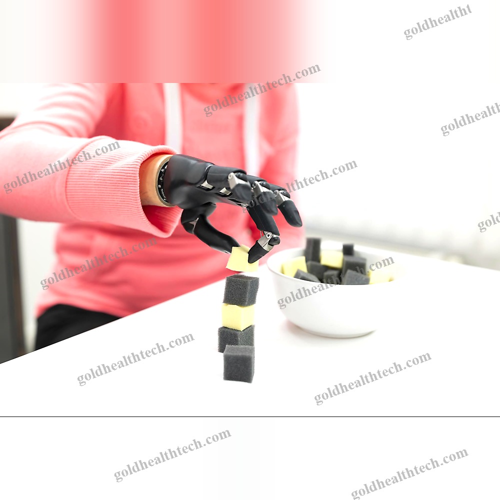 Myo-Electric Hand Prosthesis