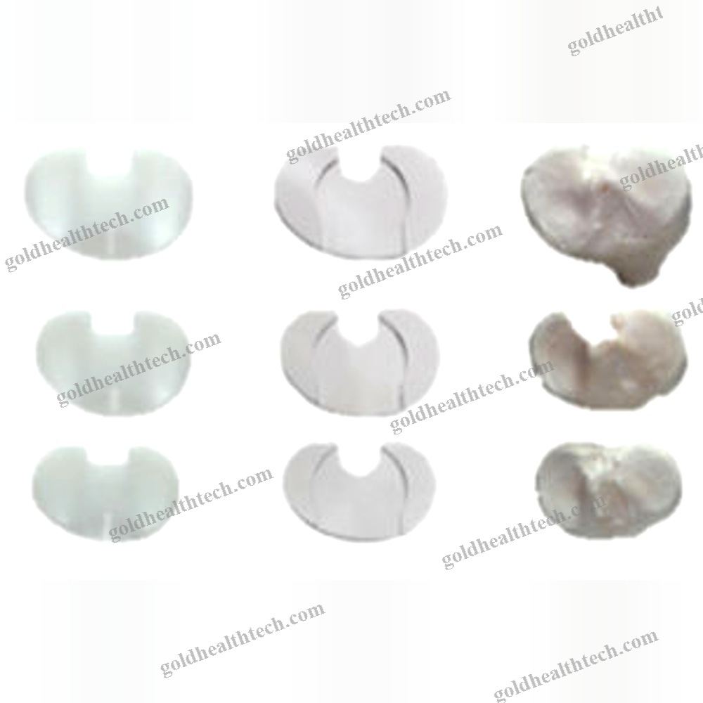 Three-Compartment Knee Prosthesis