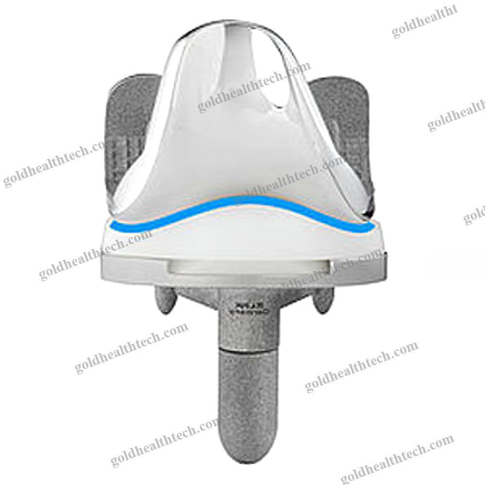 Three-Compartment Knee Prosthesis